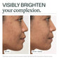 Before and after comparison of a woman's face with text 'Visibly Brighten your complexion' and 'After 4 Weeks'.