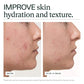 Before and after comparison of skin hydration and texture with text 'IMPROVE skin hydration and texture'.