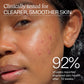 Close-up of a person's face with acne, promotional text about clinical testing for clearer, smoother skin.